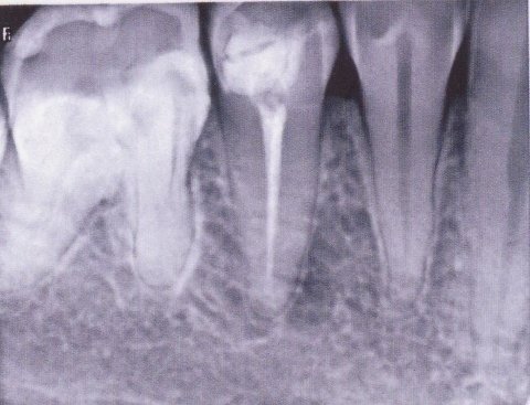 Стоматология Винницы  - Областная стоматологическая поликлиника (НА ПРАВАХ РЕКЛАМЫ), фото №20 на сайті 20minut.ua