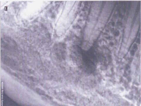 Стоматология Винницы  - Областная стоматологическая поликлиника (НА ПРАВАХ РЕКЛАМЫ), фото №19 на сайті 20minut.ua