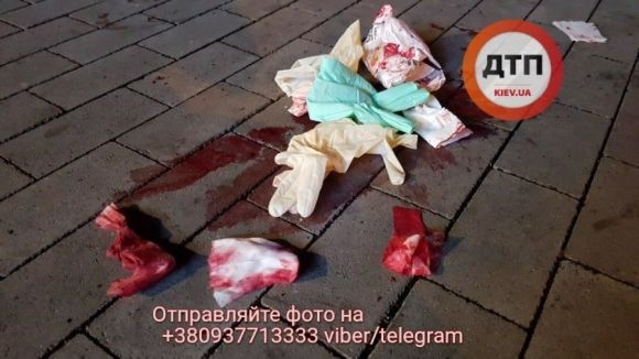 У Києві у ДТП розбився нардеп з Тернопільщини на сайті 20minut.ua У Києві у ДТП розбився нардеп з Тернопільщини, фото №3 на сайті 20minut.ua