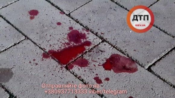 У Києві у ДТП розбився нардеп з Тернопільщини на сайті 20minut.ua У Києві у ДТП розбився нардеп з Тернопільщини, фото №4 на сайті 20minut.ua