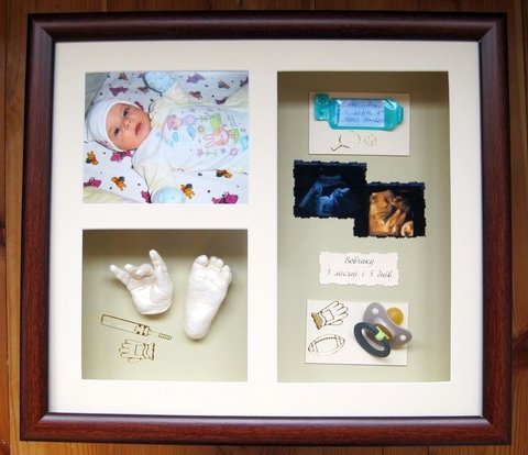 Лікар Віта Гавришенко робить гіпсові… сіднички на сайті 20minut.ua Лікар Віта Гавришенко робить гіпсові… сіднички, фото №3 на сайті 20minut.ua