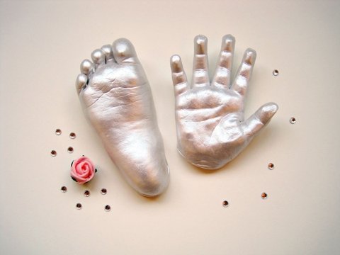 Лікар Віта Гавришенко робить гіпсові… сіднички на сайті 20minut.ua Лікар Віта Гавришенко робить гіпсові… сіднички, фото №1 на сайті 20minut.ua