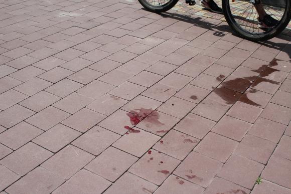 На Велодні викликали "швидку". Травмувався велосипедист, фото №3 на сайті 20minut.ua