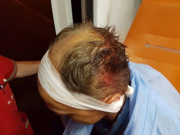 Битою розбили голову Володимиру Воловодюку, засновнику медіа-центру, фото №1 на сайті 20minut.ua