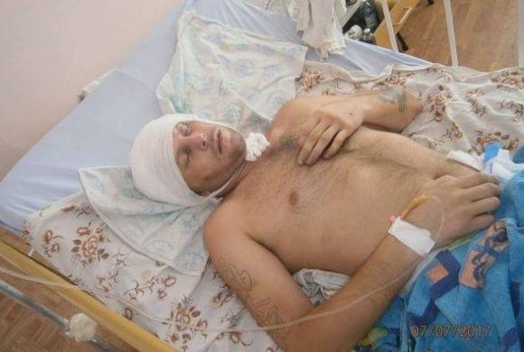 Атовець, якого жорстоко побили на Лановеччині, вже почувається краще на сайті 20minut.ua Атовець, якого жорстоко побили на Лановеччині, вже почувається краще, фото №1 на сайті 20minut.ua