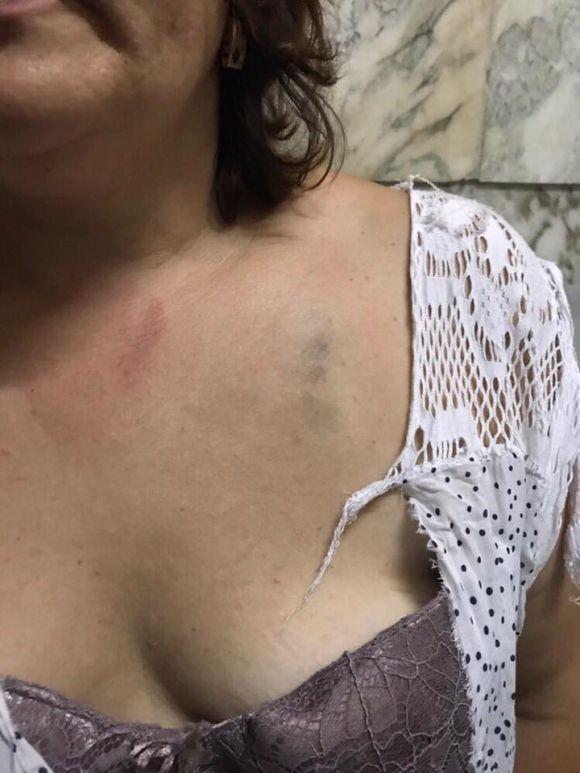 Новини Хмельницького - фото з П'яні розбірки у Лезневому: заступник голови Хмельницької РДА побився з сусідкою П'яні розбірки у Лезневому: заступник голови Хмельницької РДА побився з сусідкою, фото №3 на сайті vsim.ua