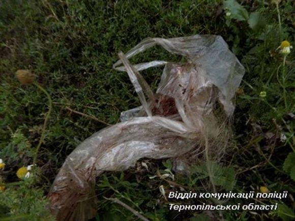 Чоловік, якого підозрюють у вбивстві жінки на побаченні, в суді просив про домашній арешт (ОНОВЛЕНО) на сайті 20minut.ua Чоловік, якого підозрюють у вбивстві жінки на побаченні, в суді просив про домашній арешт (ОНОВЛЕНО), фото №1 на сайті 20minut.ua