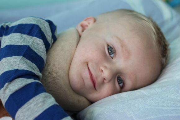 На дворічну дитину впала гілляка. Лікарі поставили помилковий діагноз та відпустили, фото №1 на сайті 20minut.ua