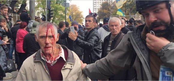 Мітинг у Києві. Онлайн-хроніка подій і пости вінничан на сайті 20minut.ua Мітинг у Києві. Онлайн-хроніка подій і пости вінничан, фото №7 на сайті 20minut.ua