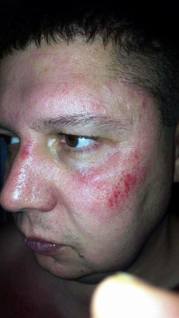 У Хмельницькому напали на антикорупціонера і голову «Автомайдану» на сайті vsim.ua У Хмельницькому напали на антикорупціонера і голову «Автомайдану», фото №1 на сайті vsim.ua