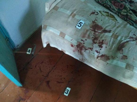 Заступився за кохану та отримав ножем в груди.  Мешканець Славутського району ледь не зарізав свого зятя, фото №1 на сайті vsim.ua