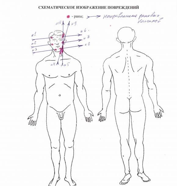 Як стріляли в ротного: у Вінниці спростували висновки донецьких про самогубство, фото №1 на сайті 20minut.ua