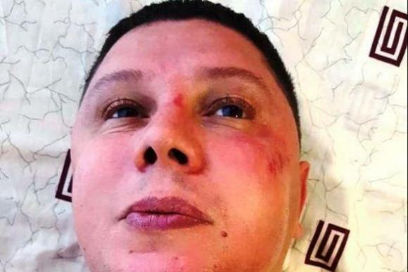 Розслідування побиття голови «Автомайдану»: активіст заявив, що на нього тисне поліція, фото №2 на сайті vsim.ua