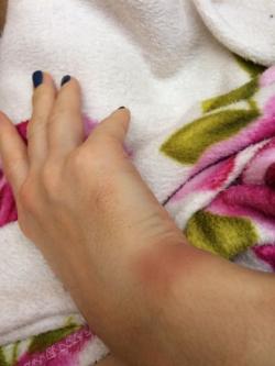 Спілкування з поліцією закінчилось кайданками та синцями, фото №2 на сайті 20minut.ua