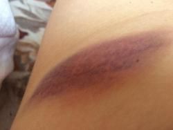 Спілкування з поліцією закінчилось кайданками та синцями, фото №1 на сайті 20minut.ua