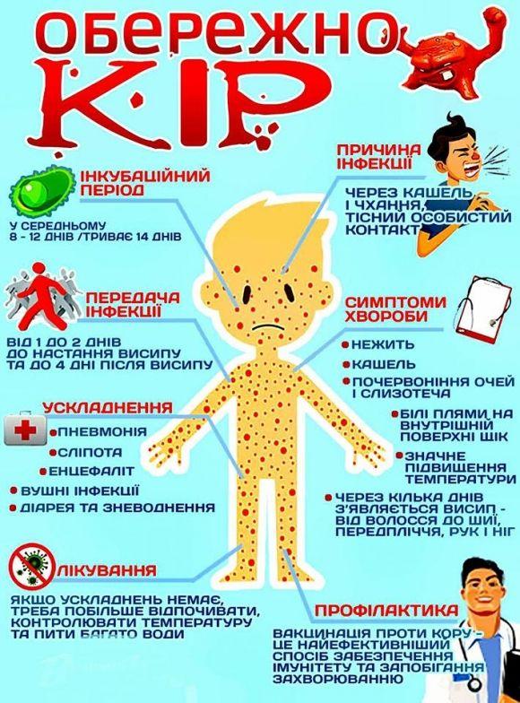 Спалах кору в Україні: в уряді просять батьків вакцинувати своїх дітей, фото №1 на сайті 20minut.ua