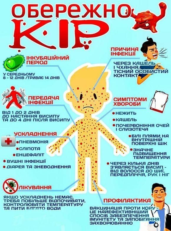 На кір в Вінниці вже захворіло 19 дітей. Що потрібно знати про хворобу на сайті 20minut.ua На кір в Вінниці вже захворіло 19 дітей. Що потрібно знати про хворобу, фото №1 на сайті 20minut.ua