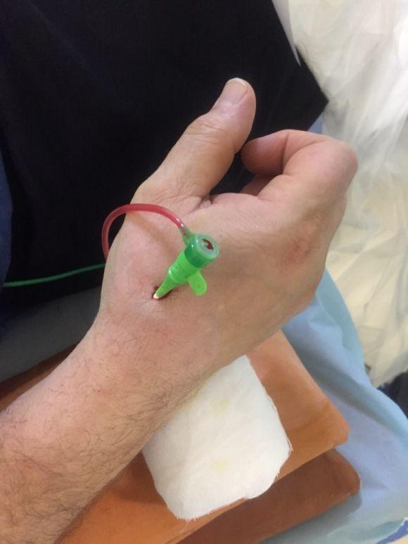 Новини Тернополя - фото з Як врятуватися від інфаркту: у Тернополі роблять унікальні операції на серці без наркозу Як врятуватися від інфаркту: у Тернополі роблять унікальні операції на серці без наркозу, фото №2 на сайті 20minut.ua