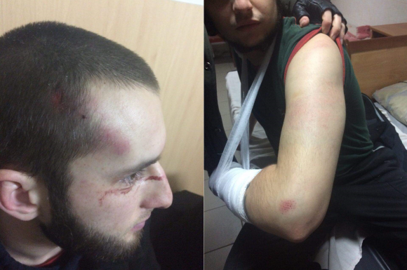 П’ятеро невідомих жорстоко побили битами активістів «Чорного комітету» (ОНОВЛЕНО), фото №1 на сайті 20minut.ua