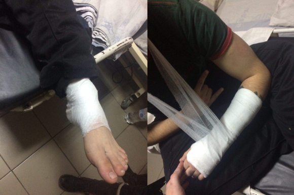 П’ятеро невідомих жорстоко побили битами активістів «Чорного комітету» (ОНОВЛЕНО), фото №2 на сайті 20minut.ua