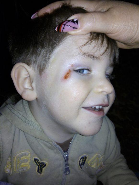 Новини Тернополя - фото з У Чорткові батьки уже втретє забирають дитину з садочка із синцем У Чорткові батьки уже втретє забирають дитину з садочка із синцем, фото №1 на сайті 20minut.ua