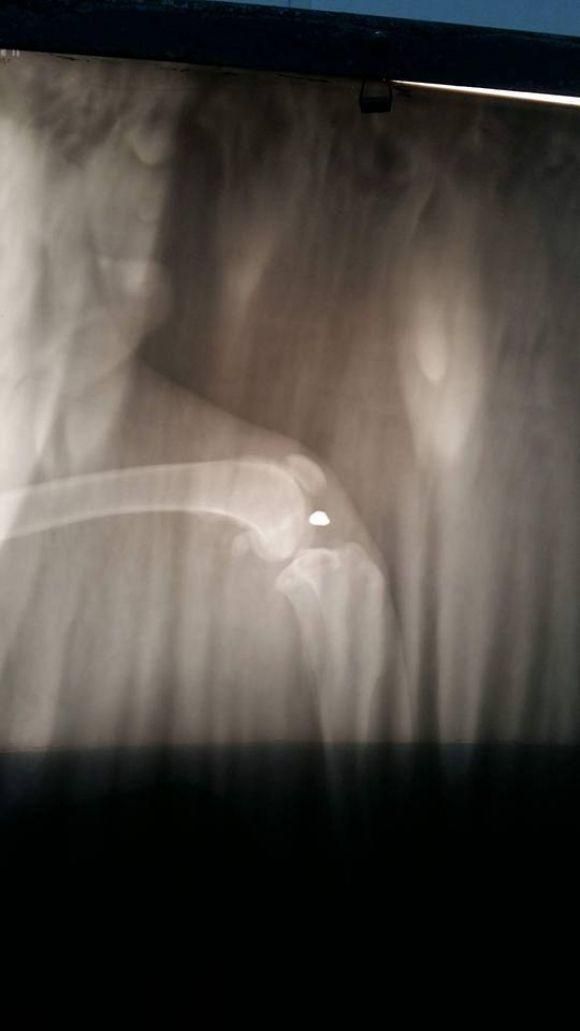 Новини Тернополя - фото з На На