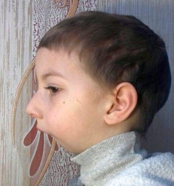 5-річний Ілля з Хмельницького готується до складної операції. Батьки просять про допомогу, фото №1 на сайті vsim.ua