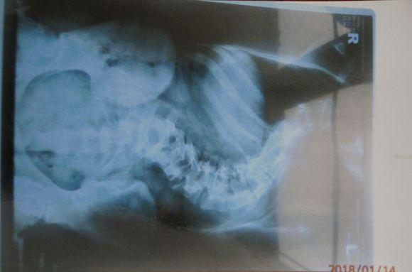 Новини Вінниці - фото з Допоможіть Лізі Насталенко вижити. Їй терміново потрібна операція Допоможіть Лізі Насталенко вижити. Їй терміново потрібна операція, фото №2 на сайті 20minut.ua