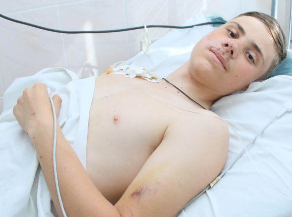 Новини Вінниці - фото з Руфер впав з дев'ятиповерхівки і залишився живим. Він у реанімації