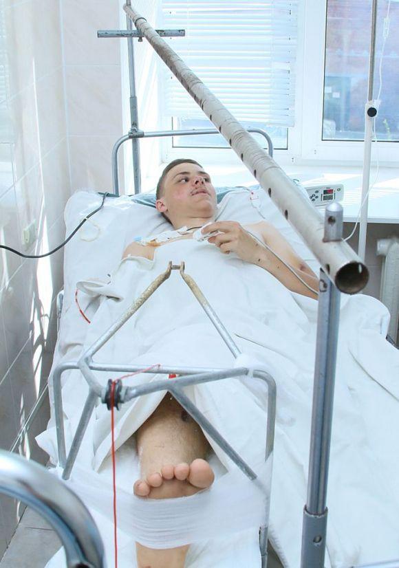Новини Вінниці - фото з Руфер впав з дев'ятиповерхівки і залишився живим. Він у реанімації