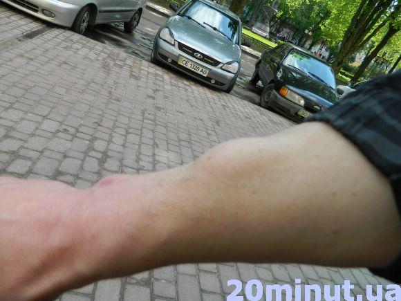 Новини Тернополя - фото з У парку Нацвідродження охоронці з "Максими" побили двох тернополян У парку Нацвідродження охоронці з "Максими" побили двох тернополян, фото №1 на сайті 20minut.ua