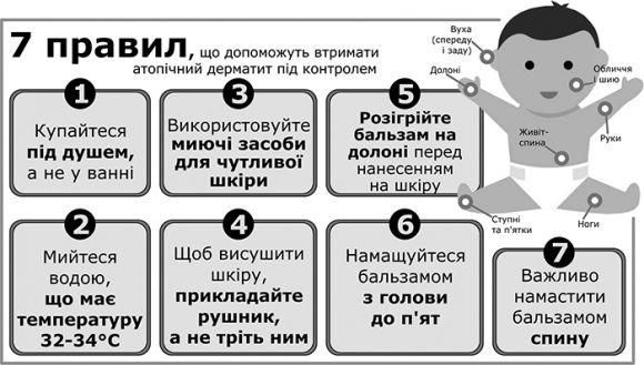 Новини Тернополя - фото з Як тепер лікують атопічний дерматит у дітей Як тепер лікують атопічний дерматит у дітей, фото №1 на сайті 20minut.ua
