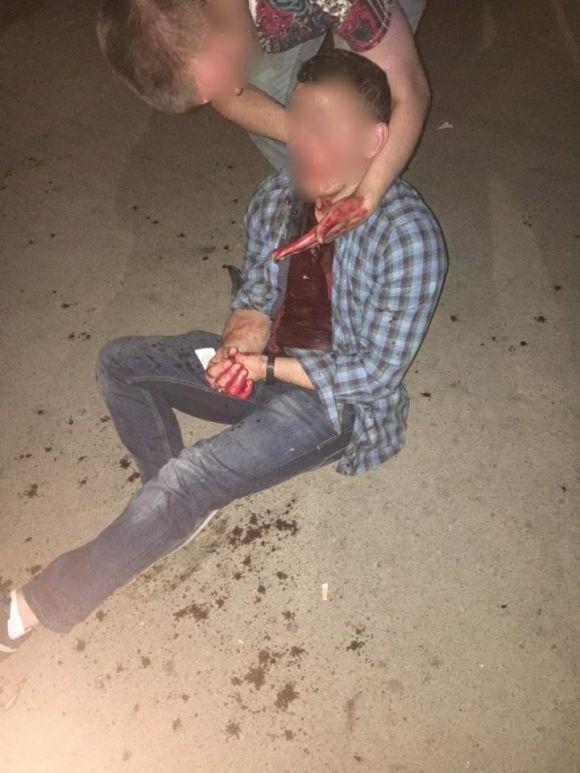 Новини Хмельницького - фото з Ніч після "перемоги" у зведеннях поліції: криваві бійки  і жодного п’яного водія Ніч після "перемоги" у зведеннях поліції: криваві бійки  і жодного п’яного водія, фото №1 на сайті vsim.ua