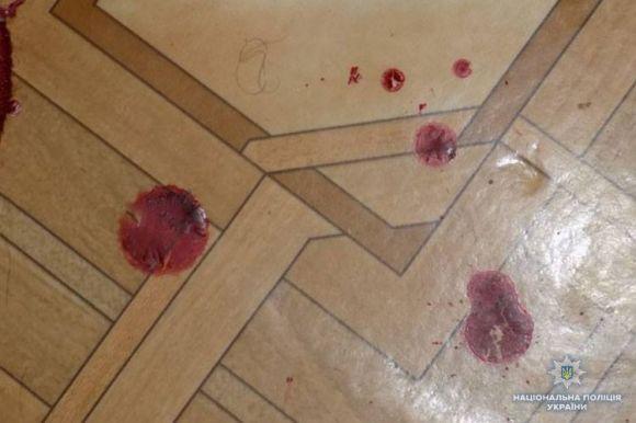 Жителька Закарпаття порізала тернополянина. Чоловік у реанімації, фото №2 на сайті 20minut.ua