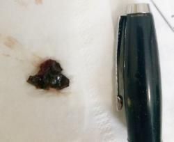 Новини Вінниці - фото з Найти «сокровища» в детском носу, поможет только лор Найти «сокровища» в детском носу, поможет только лор, фото №1 на сайті 20minut.ua