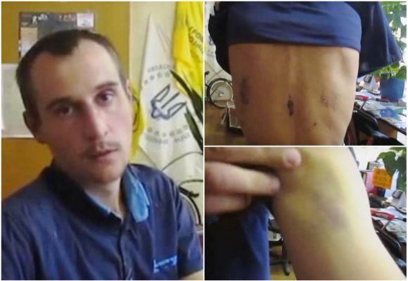 Новини Вінниці - фото з АТОвець, якого катували односельчани, пробачив кривдників за 10 тисяч гривень АТОвець, якого катували односельчани, пробачив кривдників за 10 тисяч гривень, фото №2 на сайті 20minut.ua
