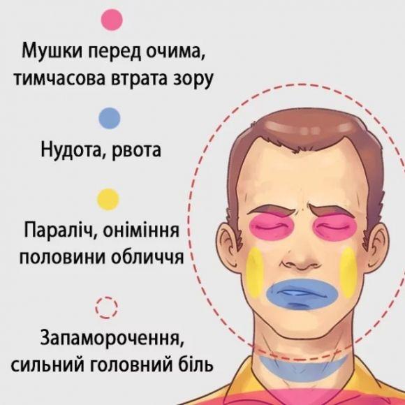 Новини Козятина - фото з Шість типів головного болю і способи швидко їх позбутись