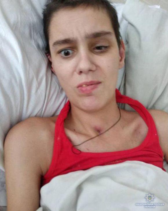 Новини Вінниці - фото з Дівчина дивом вижила після ДТП, але нічого не пам'ятає. Допоможіть упізнати Дівчина дивом вижила після ДТП, але нічого не пам'ятає. Допоможіть упізнати, фото №1 на сайті 20minut.ua