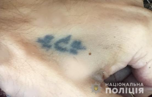 Допоможіть встановити особу знайденого у лісі Житомирського району чоловіка, фото №1 на сайті 20minut.ua