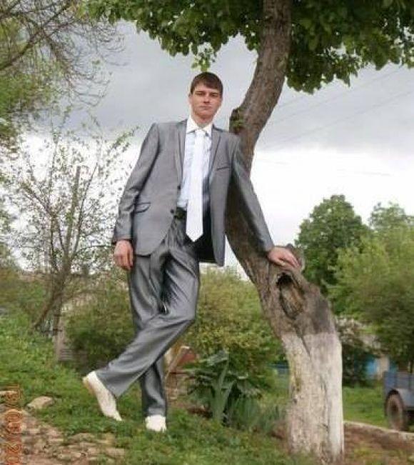 Новини Тернополя - фото з Поїхав заробляти на весілля, а повернувся зі страшною хворобою.  Друзі 23-річного Володимира просять про допомогу Поїхав заробляти на весілля, а повернувся зі страшною хворобою.  Друзі 23-річного Володимира просять про допомогу, фото №1 на сайті 20minut.ua