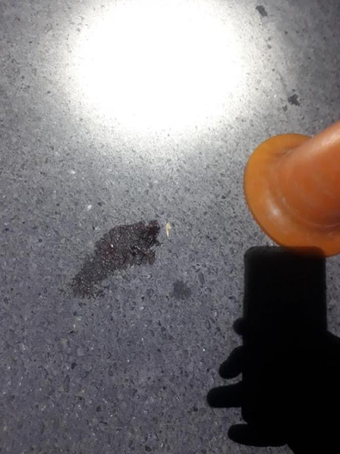 Автівка збила кам’янецького пенсіонера, фото №2 на сайті 20minut.ua