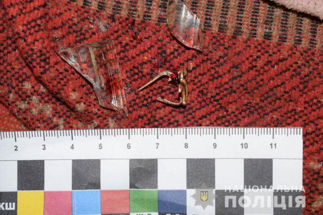 Новини Вінниці - фото з Смертельне застілля: співмешканець бив палкою вінничанку, поки вона не померла Смертельне застілля: співмешканець бив палкою вінничанку, поки вона не померла, фото №3 на сайті 20minut.ua