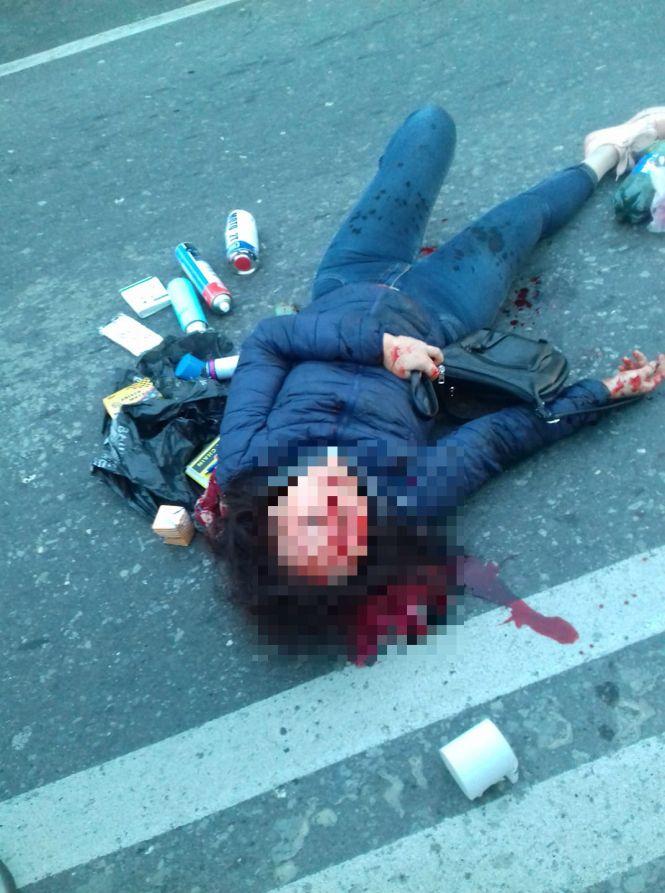 На Микулинецькій на пішохідному переході збили жінку. Вона у лікарні (шокуюче фото), фото №1 на сайті 20minut.ua