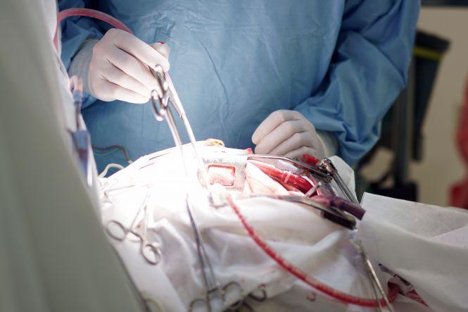 Новини Вінниці - фото з На годину зупинили серце: жмеринчанину зробили операцію в умовах штучного кровообігу На годину зупинили серце: жмеринчанину зробили операцію в умовах штучного кровообігу, фото №3 на сайті 20minut.ua