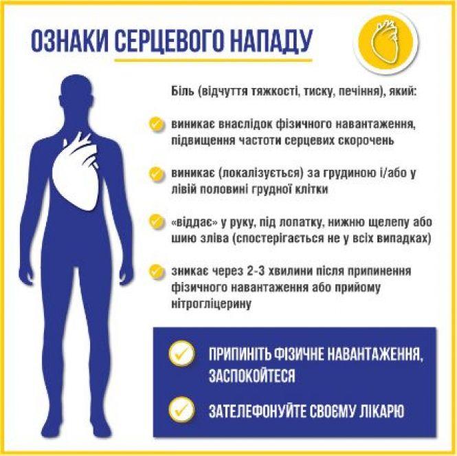 Як виявити інфаркт і що робити при серцевому нападі: коментує експерт, фото №2 на сайті 20minut.ua