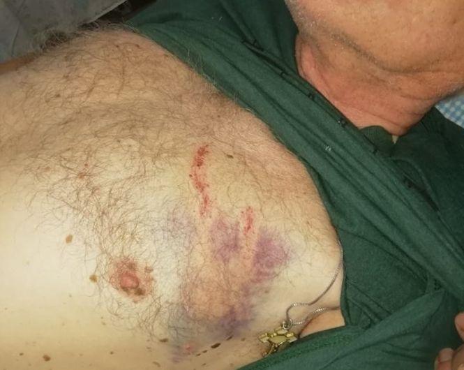 Новини Тернополя - фото з “Вчепився в руку і повалив на землю”: вовки напали на людей у двох селах Бучацького району “Вчепився в руку і повалив на землю”: вовки напали на людей у двох селах Бучацького району, фото №2 на сайті 20minut.ua