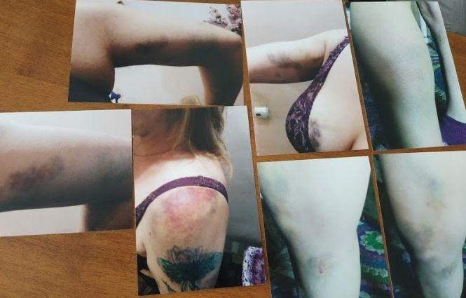 Новини Вінниці - фото з «Це не поліцейські, це поліцаї!» Подружня пара розказала, як їх затримували спецпризначенці «Це не поліцейські, це поліцаї!» Подружня пара розказала, як їх затримували спецпризначенці, фото №2 на сайті 20minut.ua