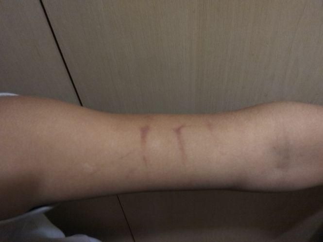 Новини Тернополя - фото з «Після занять у реабілітаційному центрі дитина прийшла із синцями», - кажуть батьки «Після занять у реабілітаційному центрі дитина прийшла із синцями», - кажуть батьки, фото №1 на сайті 20minut.ua