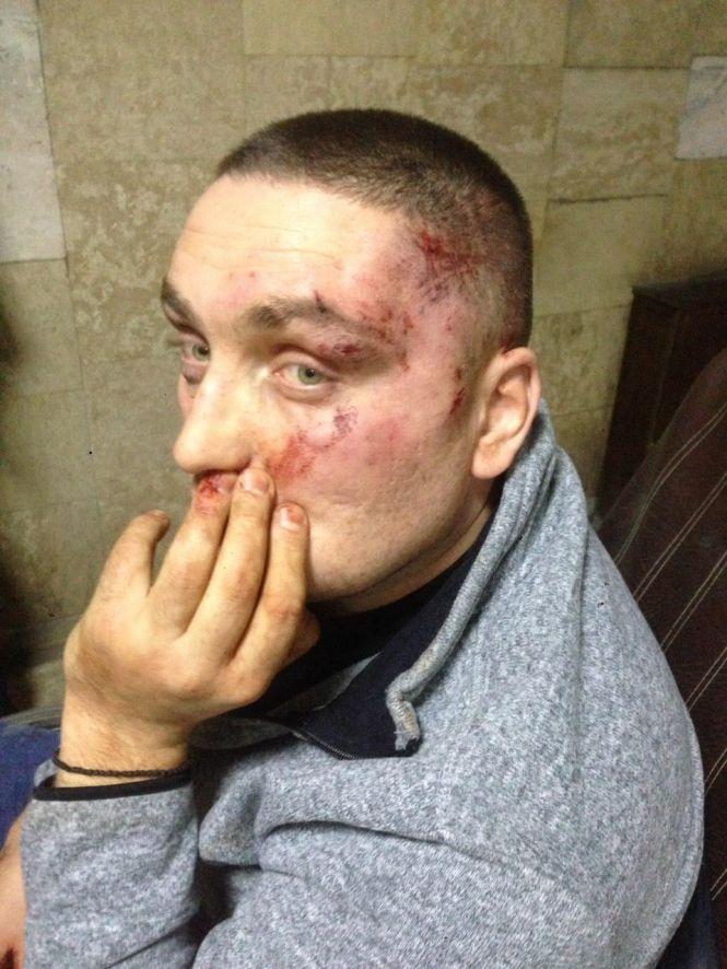 Новини Вінниці - фото з У новорічну ніч в Могилів-Подільському підрізали зятя мера. Він зараз в реанімації У новорічну ніч в Могилів-Подільському підрізали зятя мера. Він зараз в реанімації, фото №1 на сайті 20minut.ua