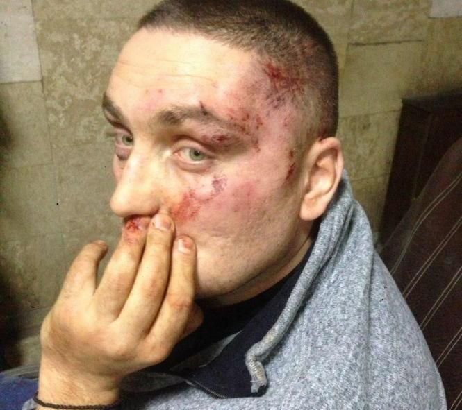 Новини Вінниці - фото з Мало не вбили зятя мера Могилів-Подільського. Подробиці новорічної бійки під рестораном Мало не вбили зятя мера Могилів-Подільського. Подробиці новорічної бійки під рестораном, фото №2 на сайті 20minut.ua